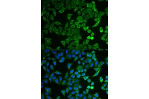 Immunofluorescence analysis of HeLa cells using NPRL2 antibody (ABIN6132809, ABIN6144787, ABIN6144788 and ABIN6221564). (NPRL2 anticorps  (AA 1-220))