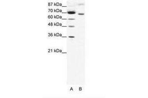 Image no. 1 for anti-Rac GTPase Activating Protein 1 (RACGAP1) (AA 20-69) antibody (ABIN202842) (RACGAP1 anticorps  (AA 20-69))