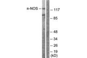 Western blot analysis of extracts from Raw264. (NOS1 anticorps  (AA 818-867))
