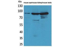 Western Blotting (WB) image for anti-HRS (HRS) (Internal Region) antibody (ABIN3180991) (HRS (HRS) (Internal Region) anticorps)