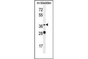 anti-Fatty Acid Desaturase Domain Family, Member 6 (FADS6) (AA 310-340), (C-Term) antibody