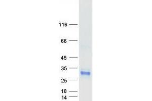 Validation with Western Blot
