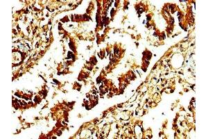 IHC image of ABIN7142886 diluted at 1:250 and staining in paraffin-embedded human lung tissue performed on a Leica BondTM system. (ADAMTS4 anticorps  (AA 213-319))