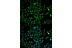 Immunofluorescence analysis of HeLa cells using TPI1 antibody.