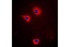 Immunofluorescent analysis of Cytochrome P450 2U1 staining in LOVO cells. (CYP2U1 anticorps  (Center))