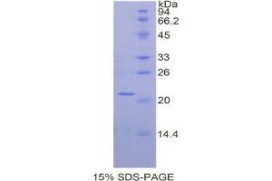 SDS-PAGE analysis of Mouse alpha Fodrin Protein. (SPTAN1 Protéine)