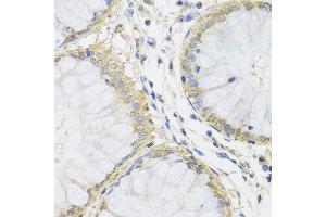 Immunohistochemistry of paraffin-embedded human colon using MTX1 antibody at dilution of 1:100 (x40 lens). (Metaxin 1 anticorps)