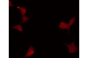 ABIN6272240 staining LOVO by IF/ICC. (MYBL1 anticorps  (Internal Region))