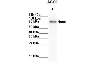 Lanes :  Lane 1: 100ug HePG2 lysate   Primary Antibody Dilution :   1:1000    Secondary Antibody :  Goat anti rabbit-HRP   Secondary Antibody Dilution :   1:8000   Gene Name :  ACO1   Submitted by :  JosÃ© Antonio BÃ¡rcena, University of CÃ³rdoba