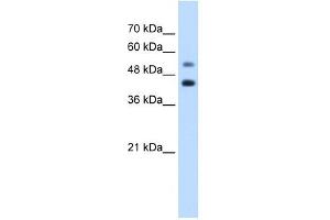 GTPBP2 antibody used at 1. (GTPBP2 anticorps  (C-Term))