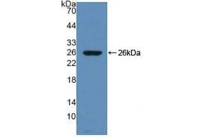 Detection of Recombinant DNM1, Mouse using Polyclonal Antibody to Dynamin 1 (DNM1) (Dynamin 1 anticorps  (AA 572-745))