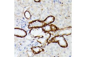 Immunohistochemistry of paraffin-embedded rat kidney using MT-ND5 antibody (ABIN7268603) at dilution of 1:100 (40x lens). (MT-ND5 anticorps  (C-Term))