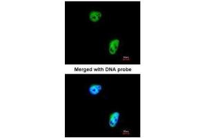 ICC/IF Image Immunofluorescence analysis of paraformaldehyde-fixed HeLa, using TLK1, antibody at 1:200 dilution.