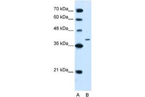 WB Suggested Anti-PTPN2 Antibody Titration:  2. (PTPN2 anticorps  (N-Term))