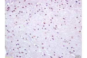 Formalin-fixed and paraffin embedded rat brain labeled with Anti Nur77 Polyclonal Antibody (ABIN747443), Unconjugated at 1:200, followed by conjugation to the secondary antibody and DAB staining (NR4A1 anticorps  (AA 351-450))