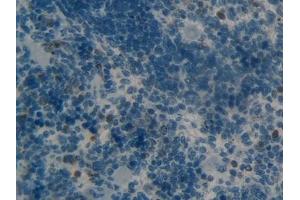 Detection of MMP9 in Rat Spleen Tissue using Polyclonal Antibody to Matrix Metalloproteinase 9 (MMP9)