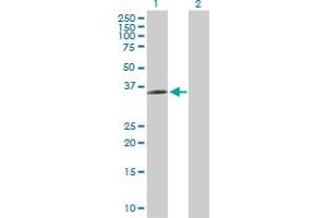 Western Blot analysis of BDKRB1 expression in transfected 293T cell line by BDKRB1 MaxPab polyclonal antibody. (BDKRB1 anticorps  (AA 1-353))