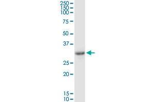 SULT1B1 MaxPab rabbit polyclonal antibody.