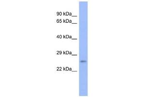 PSMB6 antibody used at 1 ug/ml to detect target protein. (PSMB6 anticorps)