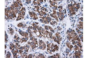 Immunohistochemistry (IHC) image for anti-ATP Synthase, H+ Transporting, Mitochondrial F1 Complex, beta Polypeptide (ATP5B) antibody (ABIN1496769)