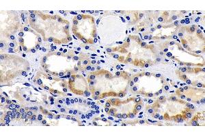 Detection of AIF in Human Kidney Tissue using Polyclonal Antibody to Apoptosis Inducing Factor (AIF)