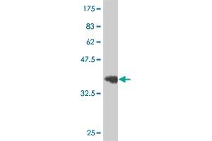 Western Blot detection against Immunogen (36. (EPH Receptor B3 anticorps  (AA 899-997))