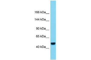 Host:  Rabbit  Target Name:  RBL2  Sample Type:  Liver Tumor lysates  Antibody Dilution:  1.