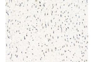 ABIN7094868 and ABIN7098920 at 1/100 staining Rat heart tissue by IHC-P.