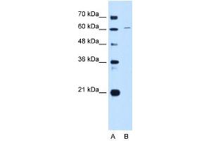 CDT1 antibody used at 1 ug/ml to detect target protein. (CDT1 anticorps  (C-Term))