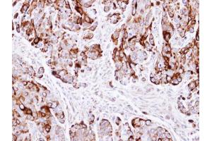 IHC-P Image Immunohistochemical analysis of paraffin-embedded HT29 xenograft , using Cytokeratin 20, antibody at 1:500 dilution.