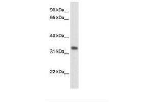 Image no. 1 for anti-3-Hydroxymethyl-3-Methylglutaryl-CoA Lyase (HMGCL) (AA 81-130) antibody (ABIN204975)