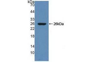 Detection of Recombinant ZPI, Rat using Polyclonal Antibody to Serpin A10 (SERPINA10) (SERPINA10 anticorps  (AA 278-425))