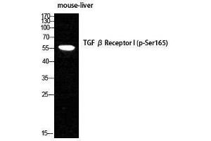 Western Blotting (WB) image for anti-Transforming Growth Factor, beta Receptor 1 (TGFBR1) (pSer165) antibody (ABIN3180463) (TGFBR1 anticorps  (pSer165))