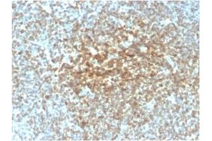 ABIN6383839 to BCL2 was successfully used to stain malignant cells in human follicular lymphoma sections. (Recombinant Bcl-2 anticorps)
