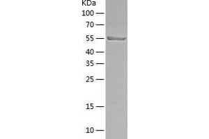 Western Blotting (WB) image for Interferon Regulatory Factor 5 (IRF5) (AA 1-498) protein (His-IF2DI Tag) (ABIN7123499)