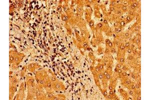 Immunohistochemistry of paraffin-embedded human liver tissue using ABIN7172938 at dilution of 1:100 (TM6SF2 anticorps  (AA 290-331))