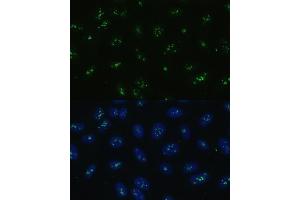 Immunofluorescence analysis of U-2 OS cells using NOLC1 antibody (ABIN6130597, ABIN6144708, ABIN6144709 and ABIN6221608) at dilution of 1:100. (NOLC1 anticorps  (AA 400-699))