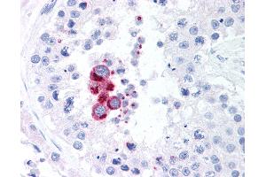 Anti-TBK1 antibody IHC of human testis. (TBK1 anticorps  (AA 563-577))