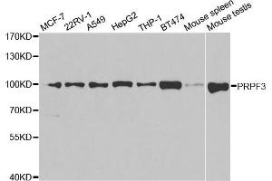 Western Blotting (WB) image for anti-PRP3 Pre-mRNA Processing Factor 3 Homolog (PRPF3) antibody (ABIN1876670) (PRPF3 anticorps)