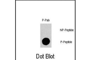 Dot blot analysis of Phospho-Gab1- polyclonal antibody (Cat. (GAB1 anticorps  (pTyr659))