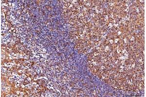 IHC analysis of ENO1 using anti-ENO1 antibody (ABIN7601902). (ENO1 anticorps  (AA 50-250))