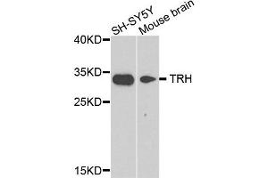 Western blot analysis of extract of SH-SY5Y and mouse brain cells, using TRH antibody.