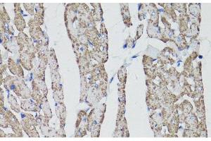 Immunohistochemistry of paraffin-embedded Rat heart using CD59 Polyclonal Antibody at dilution of 1:100 (40x lens).