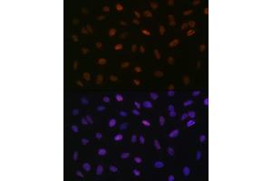 Immunofluorescence analysis of U-2 OS cells using L Rabbit mAb (ABIN7270266) at dilution of 1:100 (40x lens).