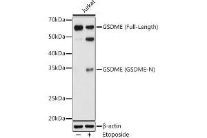 Western blot analysis of extracts of Jurkat cells, using GSDME antibody (ABIN6127757, ABIN6139554, ABIN6139555 and ABIN6223304) at 1:1000 dilution. (Non-Syndromic Hearing Impairment Protein 5 (GSDME) (AA 1-260) anticorps)
