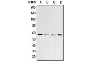 Western blot analysis of PPAR gamma (pS112) expression in HeLa colchicine-treated (A), Raw264. (PPARG anticorps  (pSer112))