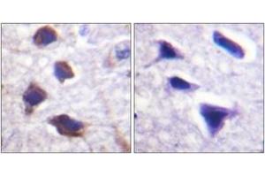 Immunohistochemistry analysis of paraffin-embedded human brain tissue, using Adrenergic Receptor beta2 (Ab-346) Antibody. (beta 2 Adrenergic Receptor anticorps  (AA 321-370))