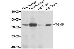Western blot analysis of extracts of various cell lines, using TGM5 antibody. (Transglutaminase 5 anticorps  (AA 461-720))