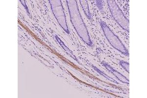 Immunohistochemistry (IHC) image for anti-Tubulin, beta 2B (TUBB2B) antibody (ABIN567611) (TUBB2B anticorps)