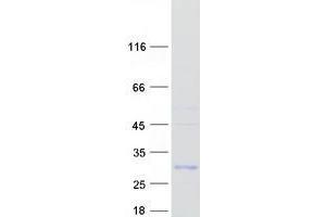 Validation with Western Blot